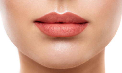 Apricot - Image 5